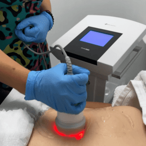 Reduce grasa localizada en Abdomen con Himfu 6 Sesiones