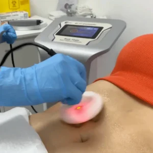 Radiofrecuencia facial tratamiento reafirmante