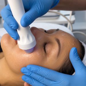 Electroporación facial con vitaminas sin agujas en Vitabella Copiapó