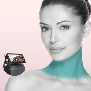 Mujer con cuello limpio y sin vello visible, mostrando piel suave y definida tras tratamiento de depilación láser con Soprano Titanium en Clínica Vitabella Copiapó.