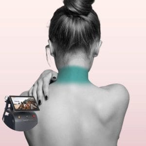 Mujer con cuello anterior o posterior sin vello, piel definida y suave tras tratamiento de depilación láser con Soprano Titanium en Clínica Vitabella Copiapó.