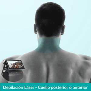 Depilación Láser Cuello Anterior o Posterior – Hombres
