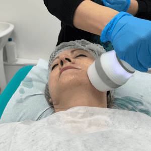 Pack Tensado Facial con Criofrecuencia — Firmeza Real sin Cirugía