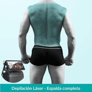 Depilación Láser Espalda Completa – Hombres