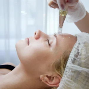 Mesoterapia Despigmentante Facial F-MELACLEAR con Microneedling