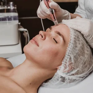 Mesoterapia Efecto Tensor F-DMAE con Microneedling
