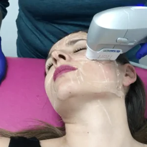 Lifting Facial HIFU 7D - Rejuvenece Sin Cirugía