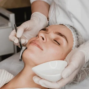Peeling Iluminador Despigmentante Antiedad (Ferulic Peel)