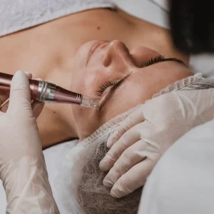 Mesoterapia Antiox-Filler (Microneedling + Vitaminas)