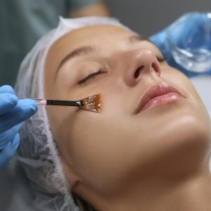 Peeling Antiedad + Péptidos 1 Sesión - Rejuvenecimiento Facial progresivo