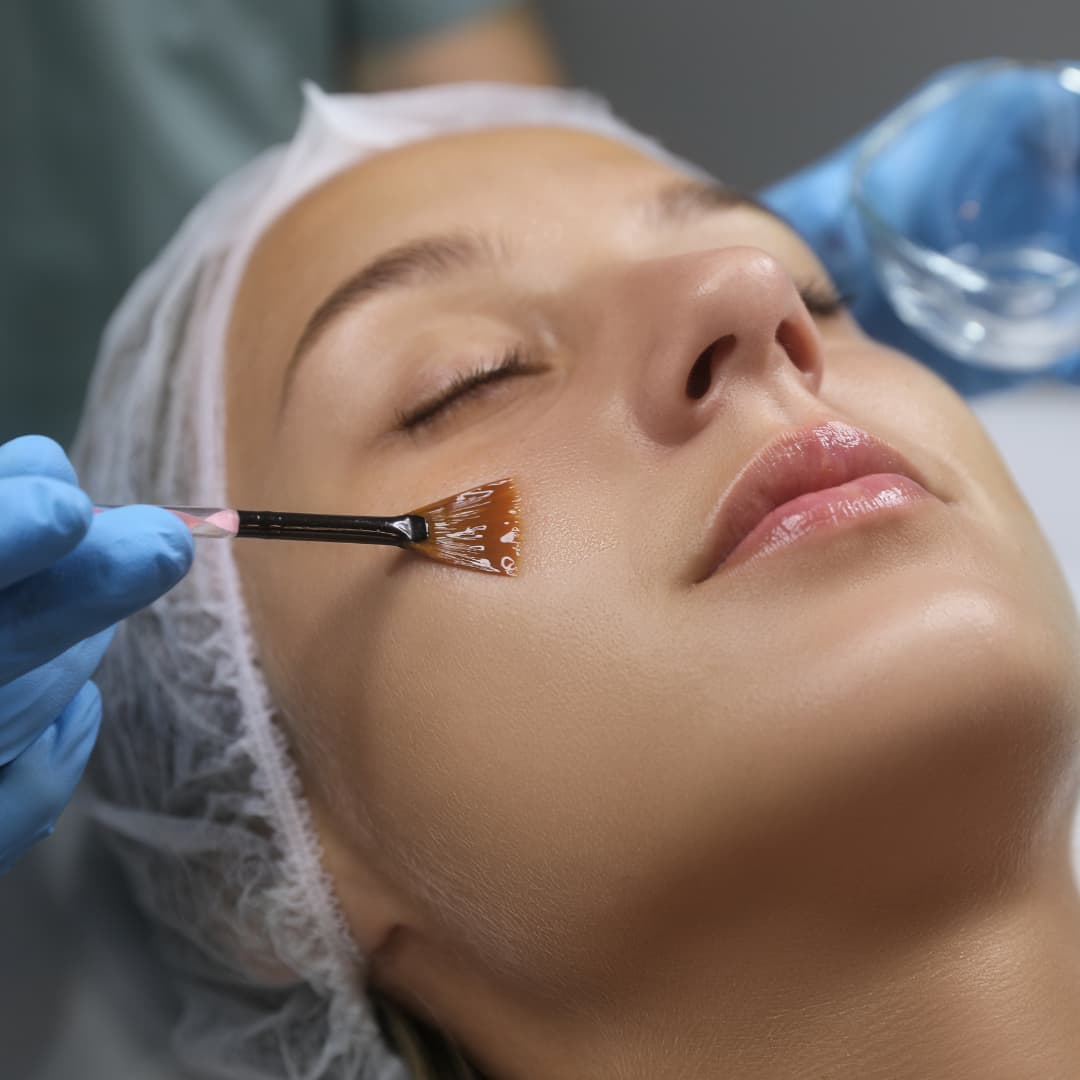 Peeling Antiedad + Péptidos 1 Sesión - Rejuvenecimiento Facial progresivo